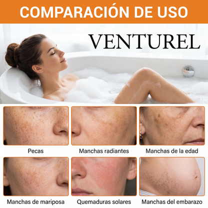 Turmeric Glow Soap - Limpieza Facial Natural | Piel limpia, sin acné y con glow real